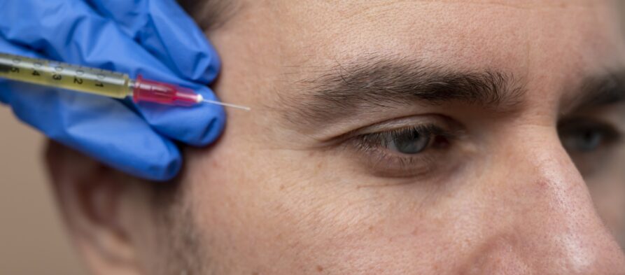 botox preventivo
