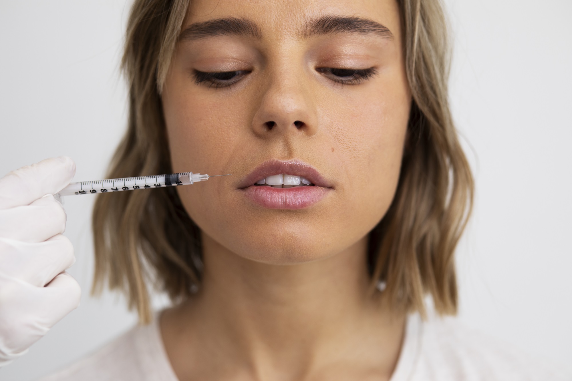 botox preventivo